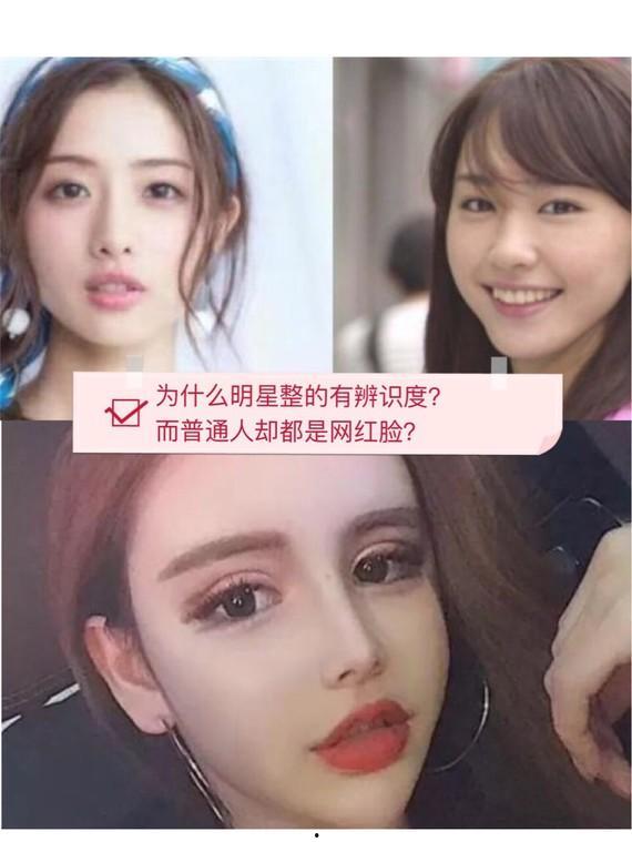 苏州网红整形,美丽蜕变背后的秘密解析