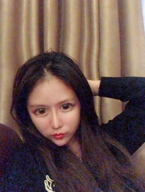 整容网红周,揭秘整容背后的美丽与争议