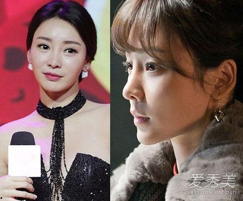 女明星整容前后照片,揭秘女明星整容前后容貌巨变